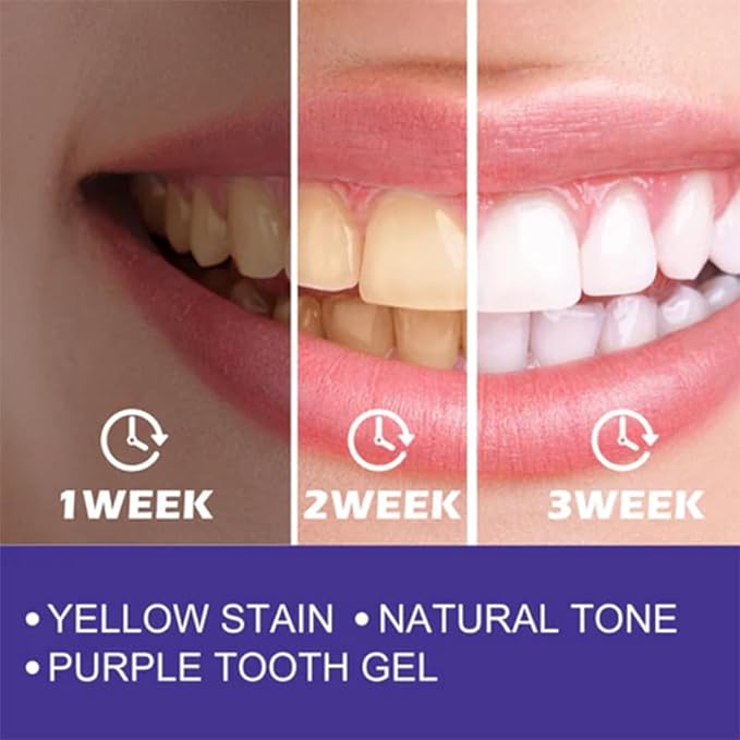 Purple Whitening Toothpaste - ZainaMart