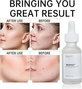 Ordinary Buffet Serum - ZainaMart